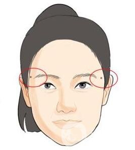 點痣后注意事項一定要遵守，否則會留疤！