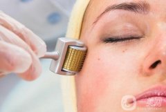 果酸換膚一次多少錢？要做幾次才*？