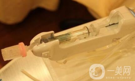 注射去皺紋