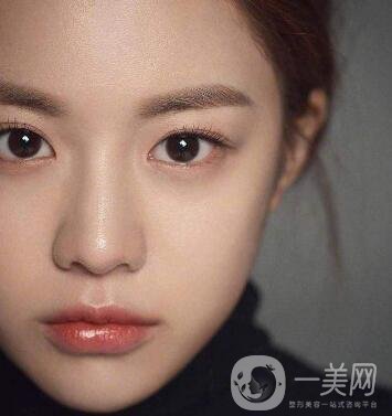 如何讓鼻梁變高？可以注射玻尿酸嗎？
