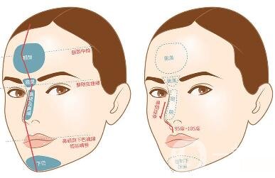 如何讓鼻梁變高？可以注射玻尿酸嗎？