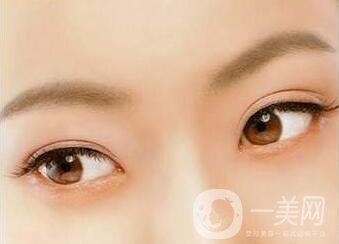 三點(diǎn)定位雙眼皮手術(shù)后應(yīng)該注意些什么？