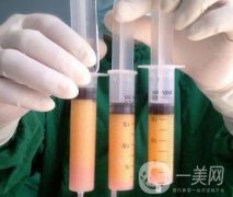 臉吸脂手術(shù)多久恢復(fù)?有什么危害?