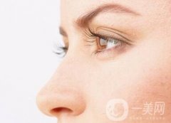 墊個鼻子要多少錢？大概價位是多少？