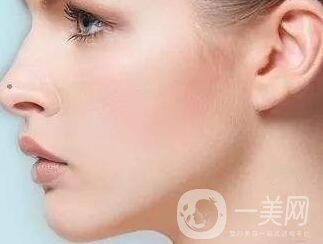 墊個鼻子要多少錢？大概價位是多少？