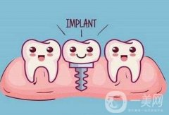 貴金屬烤瓷牙有哪些種類？
