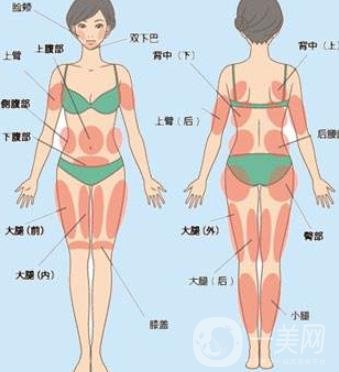 全身抽脂價格是多少？