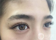 如何減少眼部皺紋？哪些方法比較*？