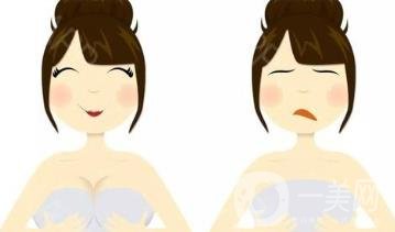 玻尿酸隆胸