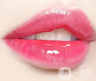 豐唇手術(shù)價(jià)格貴不貴？要多少錢(qián)？