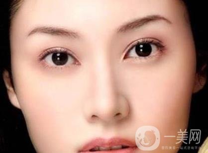 吸雕雙眼皮手術(shù)是什么？是埋線嗎？