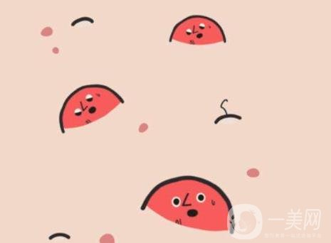 像素激光去痘的*果好嗎？會(huì)反彈嗎？