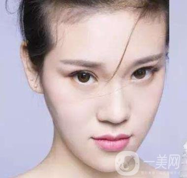 像素激光去痘的*果好嗎？會(huì)反彈嗎？