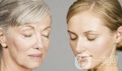 注射瘦臉去法令紋*果嗎?真的好嗎