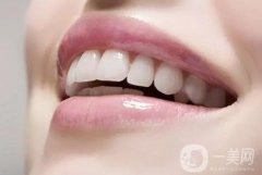 烤瓷牙的種類有哪些?哪種比較好?