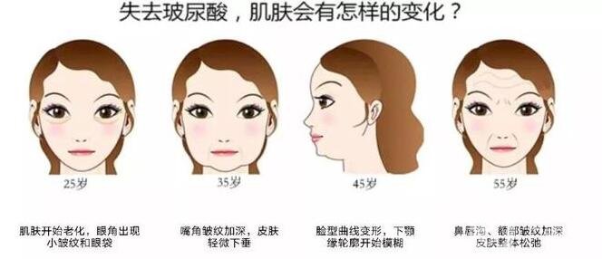 注射瑞藍(lán)玻尿酸價(jià)格是全國(guó)統(tǒng)一的嗎?有哪些區(qū)別