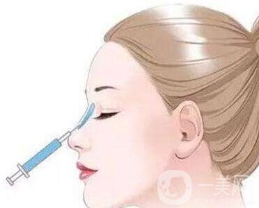 瑞蘭玻尿酸注射除皺*果怎么樣？