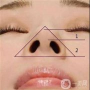 鼻頭縮小手術(shù)價錢大概是多少？