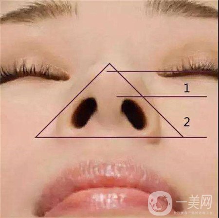 鼻頭縮小手術價錢大概是多少？