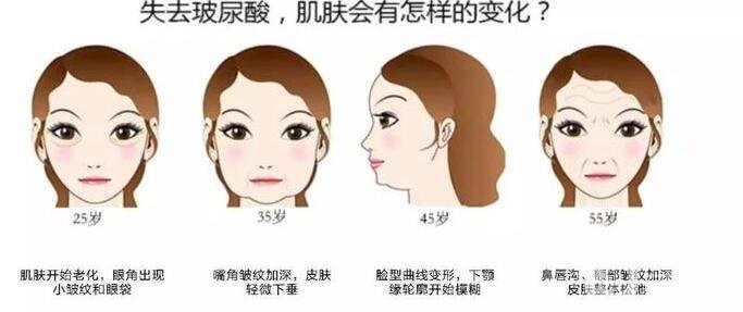 【至小白篇】玻尿酸有幾種品牌和類(lèi)型?