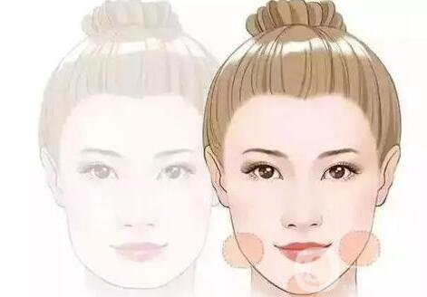 【至小白篇】玻尿酸有幾種品牌和類(lèi)型?