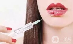 注射玻尿酸豐下巴多久恢復自然?會反彈嗎?