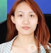 長沙微恩醫(yī)療整形醫(yī)院價格表，附隆鼻真實恢復(fù)案例