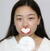 西南醫(yī)院整形美容外科價格表，附雙眼皮手術(shù)果一覽