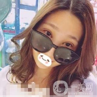 濟(jì)南旭美整形醫(yī)院靠譜嗎?附雙眼皮案例和全新價格表
