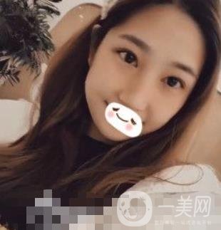 濟(jì)南旭美整形醫(yī)院靠譜嗎?附雙眼皮案例和全新價格表