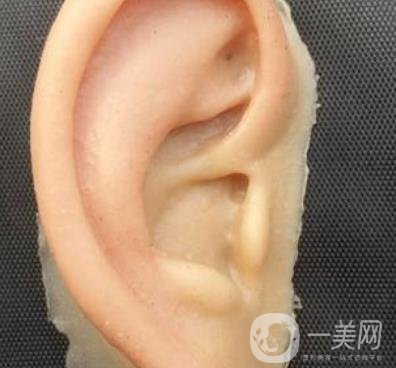 2020年石家莊第(一)醫(yī)院整形美容科價格表和耳朵畸形修復(fù)案例一覽