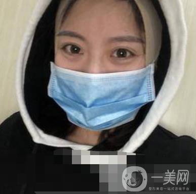 河北省人民醫(yī)院整形外科價(jià)格表新版來(lái)襲，附去下頜骨案例