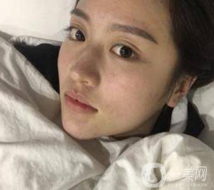 河北省人民醫(yī)院整形外科價(jià)格表新版來(lái)襲，附去下頜骨案例