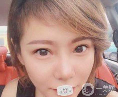 綿陽中心醫(yī)院整形美容科價格表2020發(fā)布，附祛眼袋案例