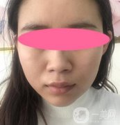 寧波第一醫(yī)院整形科價格表收費(fèi)明細(xì)上線，看打玻尿酸真人案例