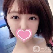 上海華山醫(yī)院整形外科價(jià)格表明細(xì)及割雙眼皮日記分享