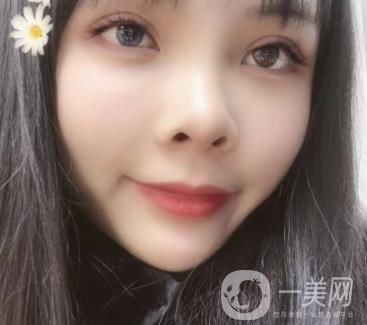 西安交通大學(xué)附屬醫(yī)院整形美容科價格表和雙眼皮案例一覽