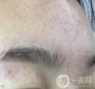 南京省中醫(yī)院整形美容科祛黃褐斑多少錢？價(jià)格表及案例詳情一覽