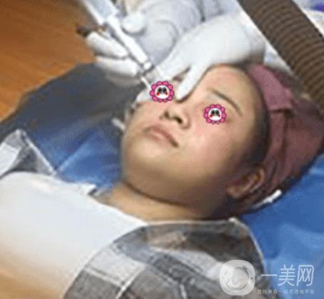 岳陽市第一人民醫(yī)院整形美容科祛斑好嗎？價格表和案例日記分享