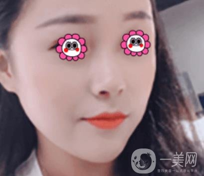 岳陽市第一人民醫(yī)院整形美容科祛斑好嗎？價格表和案例日記分享