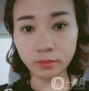 中山一院整形科價(jià)格表,及切腋臭日記一覽