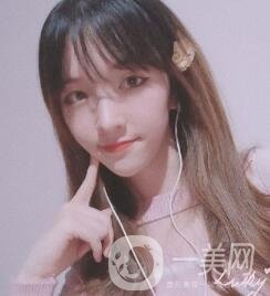 南昌二附院整形科價格表2020，附肋軟骨隆鼻整形案例