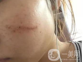 西安市中心醫(yī)院整形科價(jià)目?jī)r(jià)格一覽，附陶諫祛疤案例*果圖