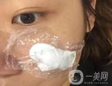 西安市中心醫(yī)院整形科價(jià)目?jī)r(jià)格一覽，附陶諫祛疤案例*果圖