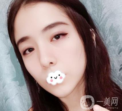上海伯思立整形怎么樣？附沈國雄隆鼻案例及整形價格表
