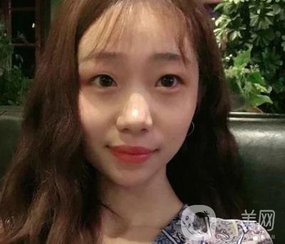 上海華美李志海磨骨多少錢(qián)？案例有嗎？整形價(jià)格表一覽