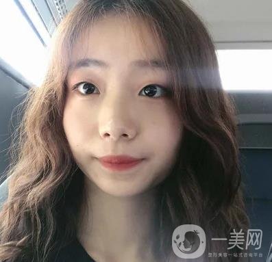 上海華美李志海磨骨多少錢(qián)？案例有嗎？整形價(jià)格表一覽