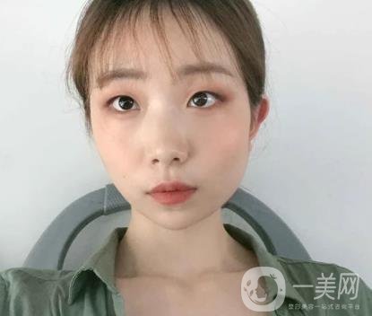 上海華美李志海磨骨多少錢(qián)？案例有嗎？整形價(jià)格表一覽