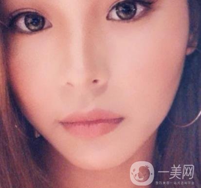 上海九院切下頜角手術(shù)經(jīng)歷分享，附2020整形價(jià)格一覽表