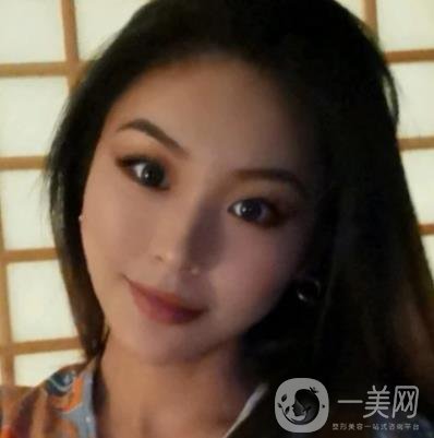 上海九院切下頜角手術(shù)經(jīng)歷分享，附2020整形價(jià)格一覽表